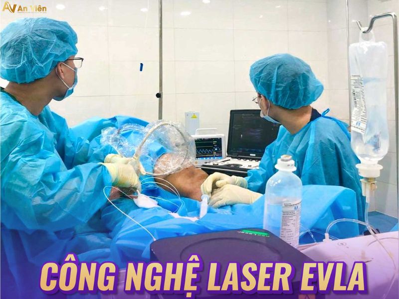 can thiệp laser