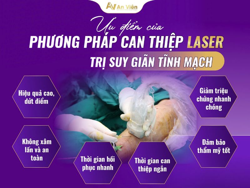 can thiệp laser, rf