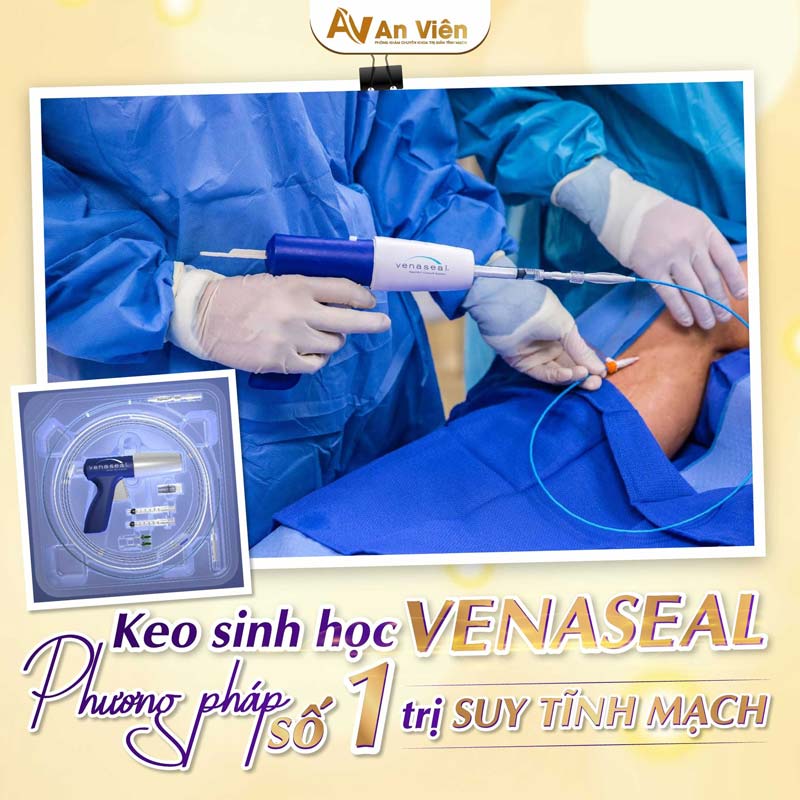 keo sinh học Venaseal