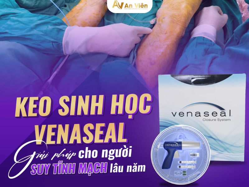 keo sinh học Venaseal