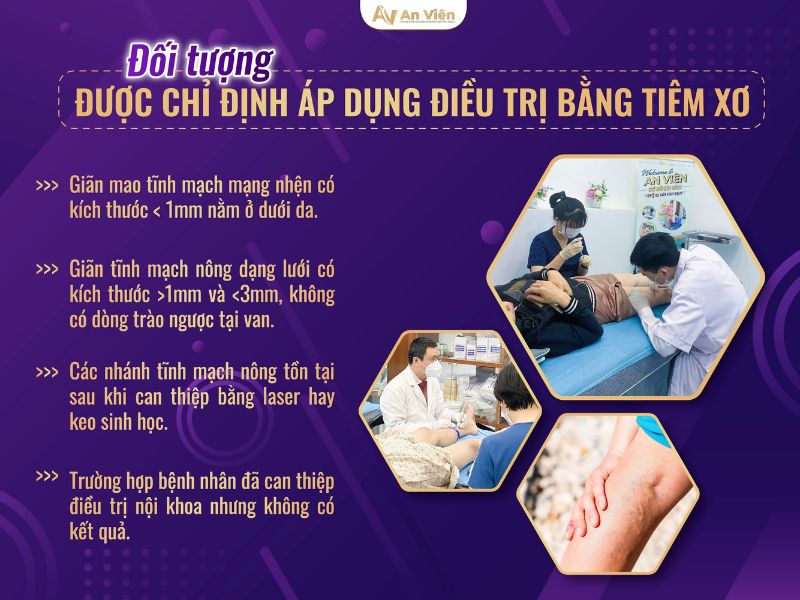 tiêm xơ tĩnh mạch
