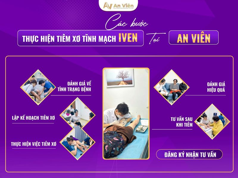 tiêm xơ tĩnh mạch