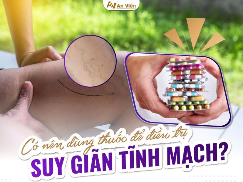 các phương pháp điều trị suy giãn tĩnh mạch!