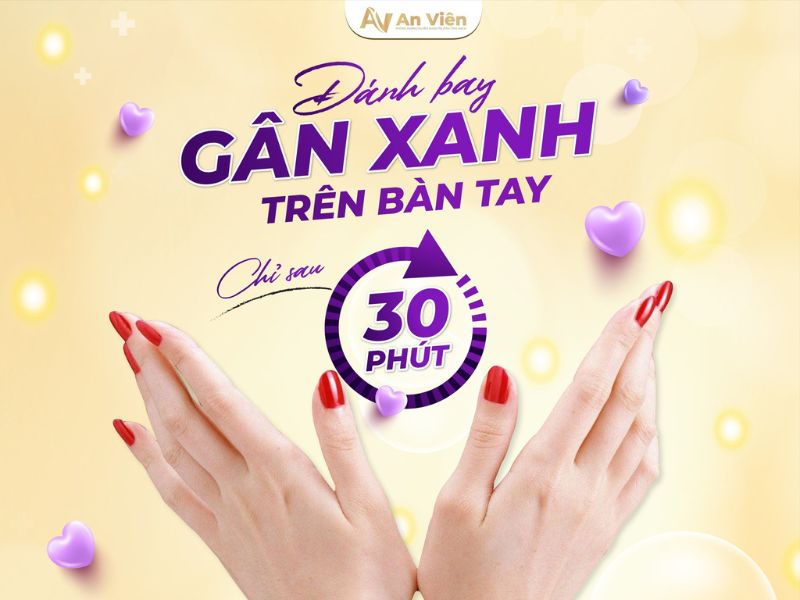 chữa trị giãn tĩnh mạch tay
