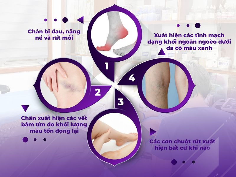 Giãn tĩnh mạch có di truyền không