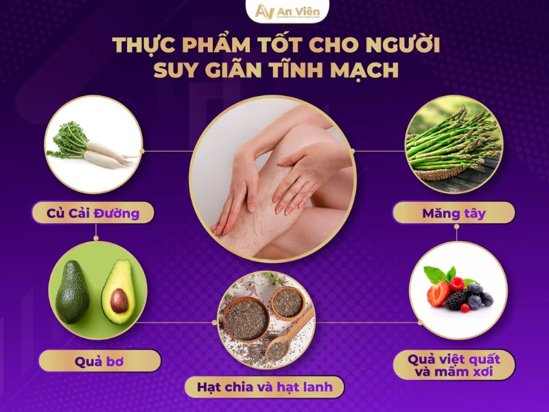ngăn ngừa giãn tĩnh mạch