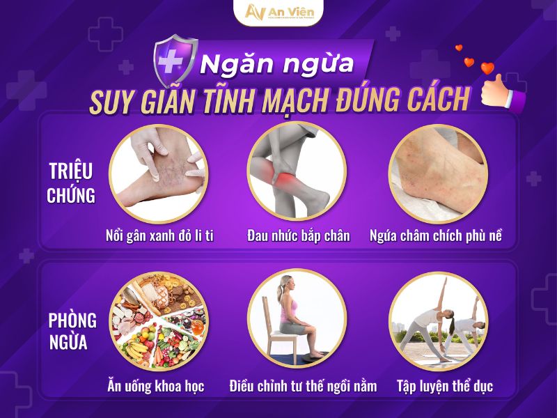 ngăn ngừa giãn tĩnh mạch
