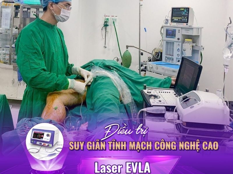 Nguyên nhân bị giãn tĩnh mạch
