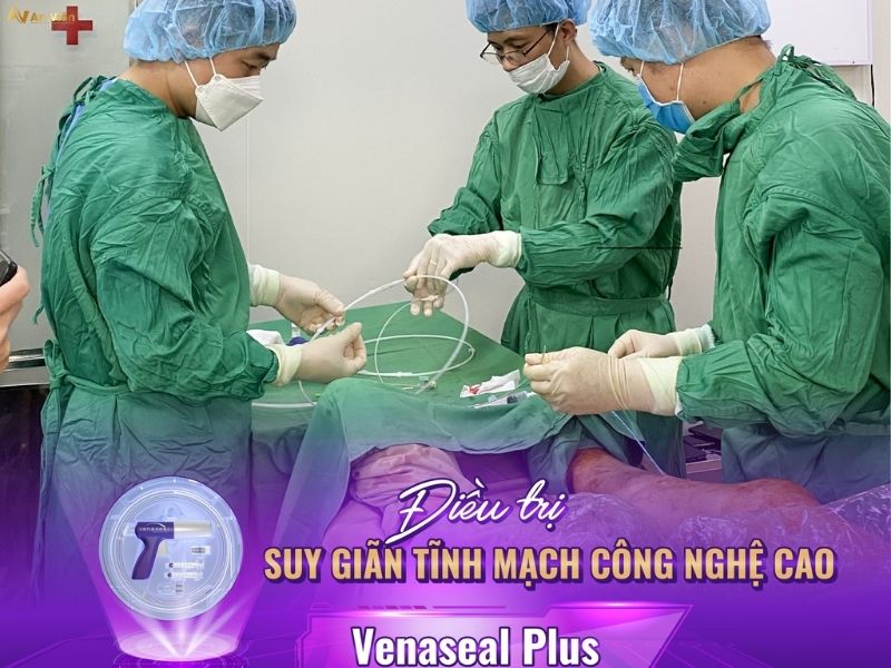 Nguyên nhân bị giãn tĩnh mạch