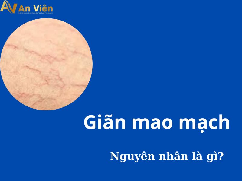 sự khác biệt giãn mao mạch và giãn tĩnh mạch