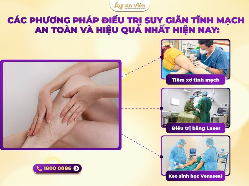 Suy giãn tĩnh mạch chân nên điều trị ở đâu