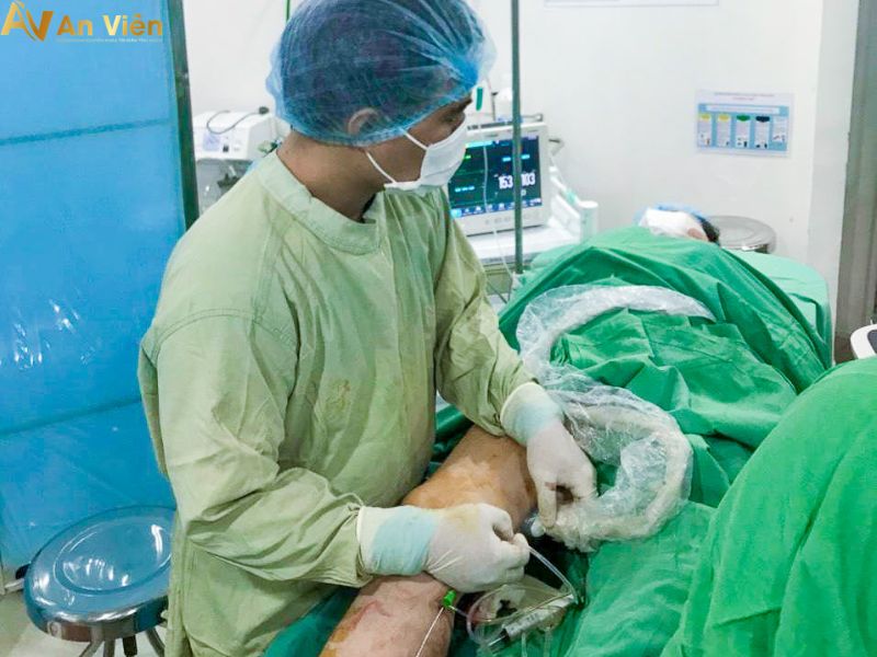 tĩnh mạch mạng nhện