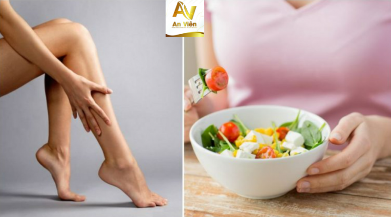 Suy giãn tĩnh mạch chân nên ăn gì? Nên kiêng gì và tập luyện như thế nào?