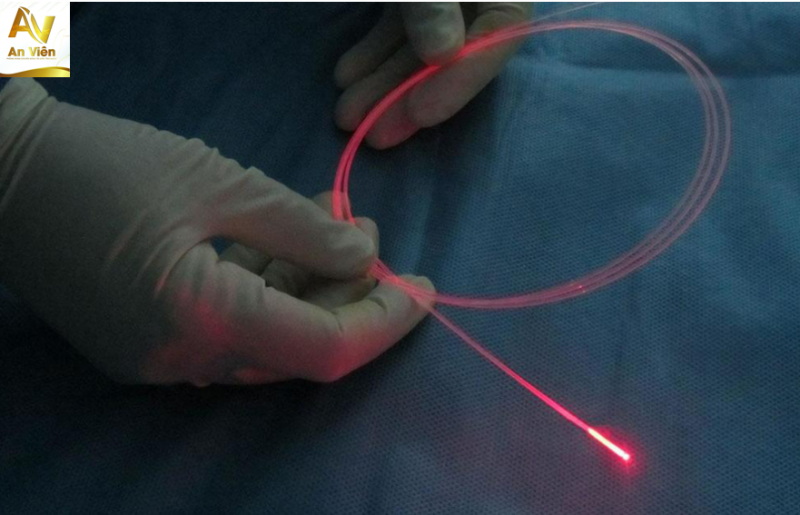 Laser nội mạch là sử dụng tia laser công suất thấp chiếu vào lòng tĩnh mạch