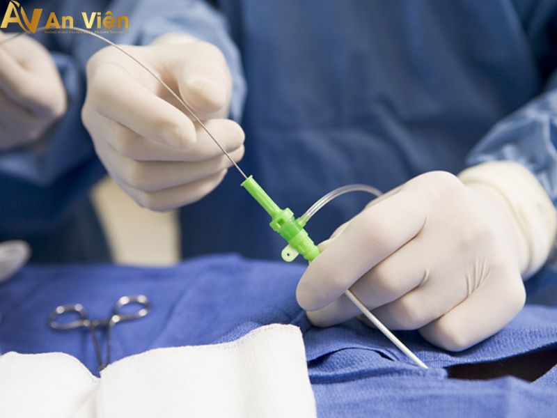 Điều trị bệnh suy giãn tĩnh mạch tại An Viên