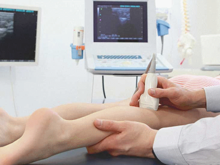 Siêu âm Doppler suy giãn tĩnh mạch chi dưới