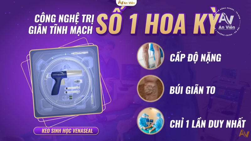 Phương pháp điều trị bằng keo sinh học Venaseal trị dứt điểm suy giãn tĩnh mạch chi dưới