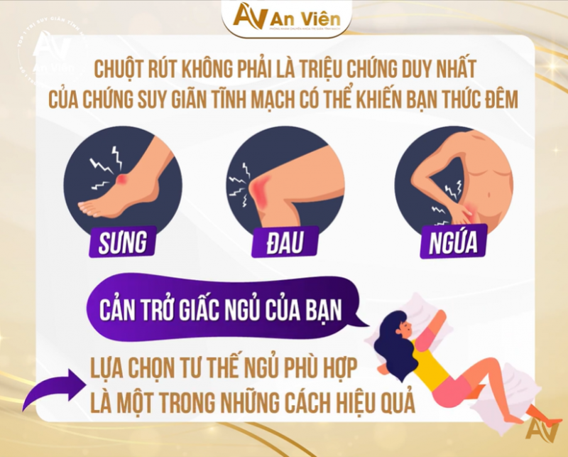 Tư thế ngủ giúp bạn tránh bị ảnh hưởng bởi suy giãn tĩnh mạch