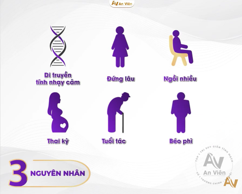 Nguyên nhân bị suy giãn tĩnh mạch sâu