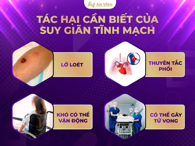 Điều trị bệnh suy giãn tĩnh mạch An Viên