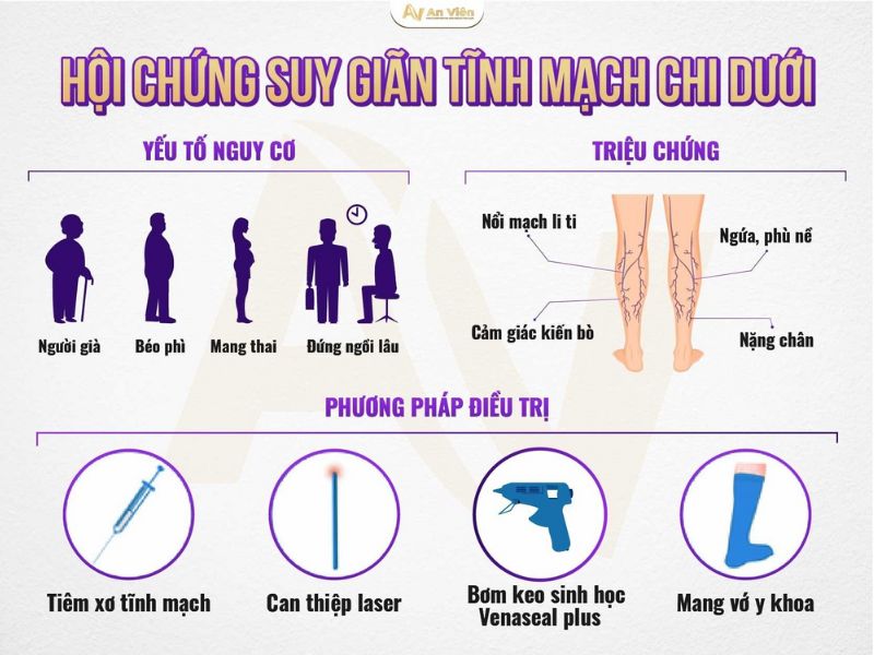 Điều trị bệnh tĩnh mạch tại Đà Nẵng