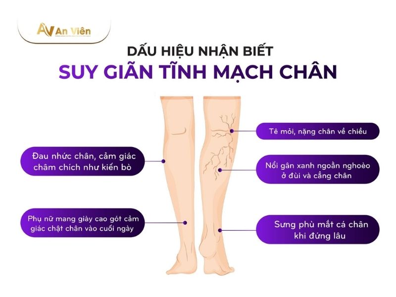 Điều trị bệnh tĩnh mạch tại Đà Nẵng