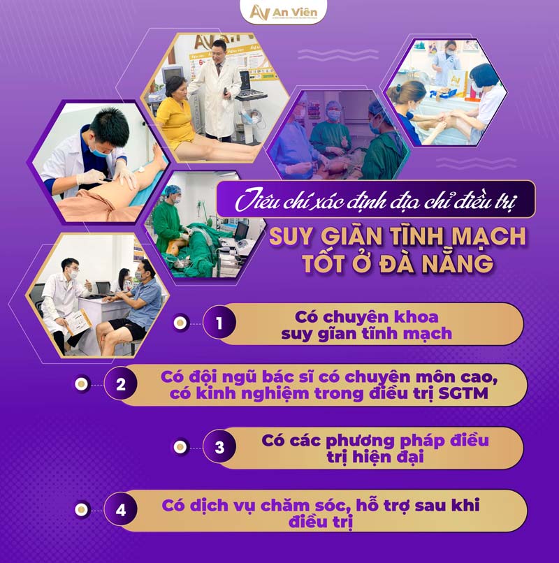 Điều trị bệnh tĩnh mạch tại Đà Nẵng