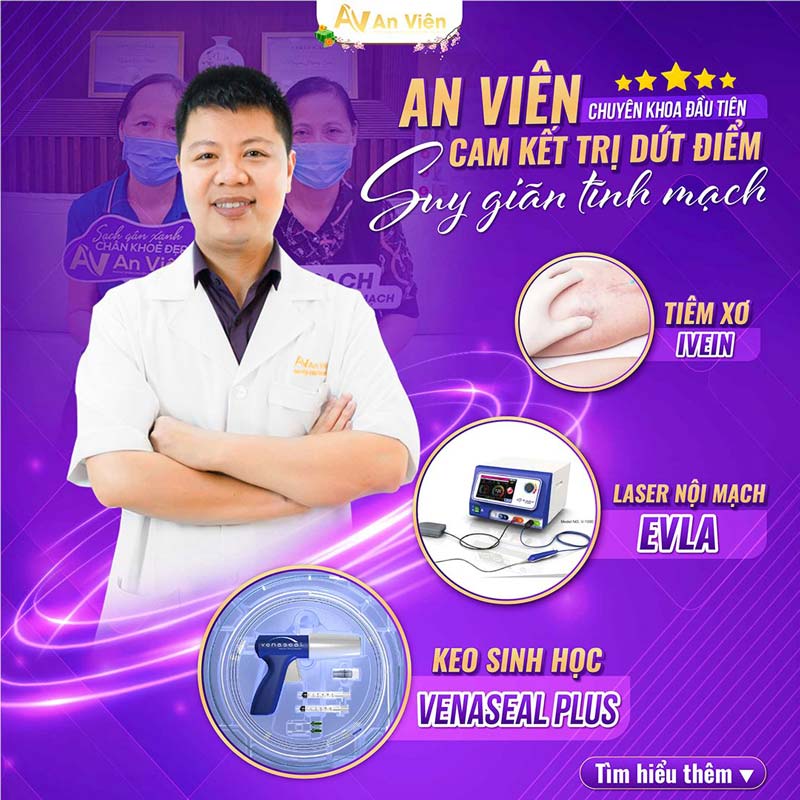 Điều trị suy giãn tĩnh mạch An Viên hai