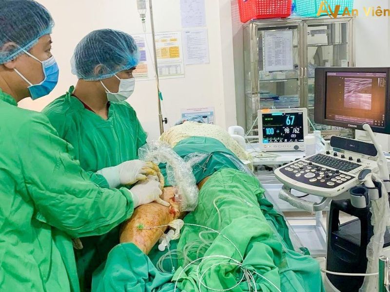 điều trị suy giãn tĩnh mạch Đà Nẵng