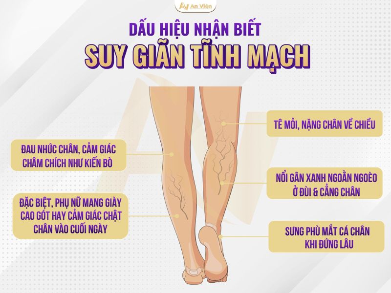 Sự suy giảm chức năng của tĩnh mạch đã gây nên các triệu chứng khó chịu như: