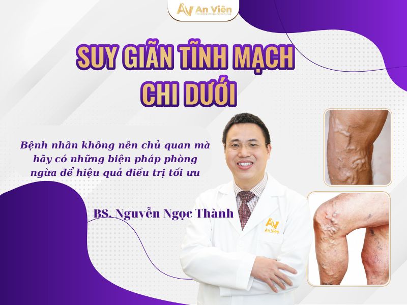 Điều trị tĩnh mạch An Viên