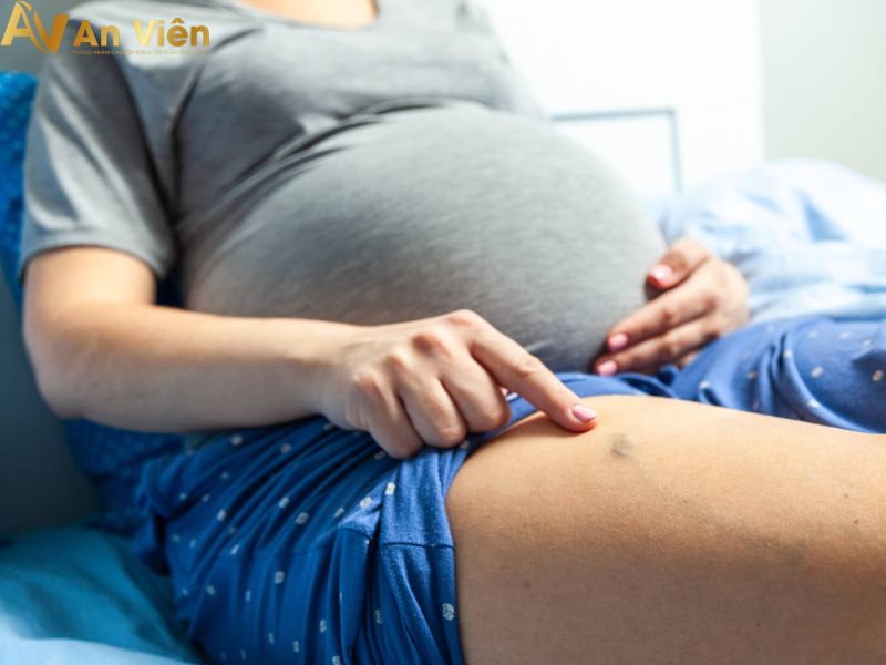 Bà bầu bị giãn tĩnh mạch chân