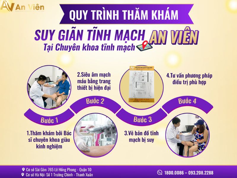 Kiểm tra bệnh giãn tĩnh mạch ở TPHCM