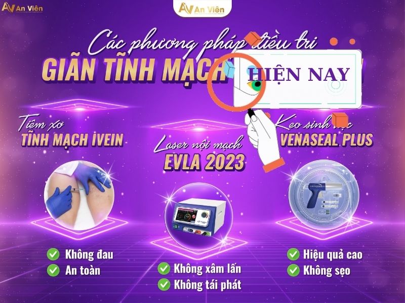 Nơi khám bệnh tĩnh mạch ở Đà Nẵng