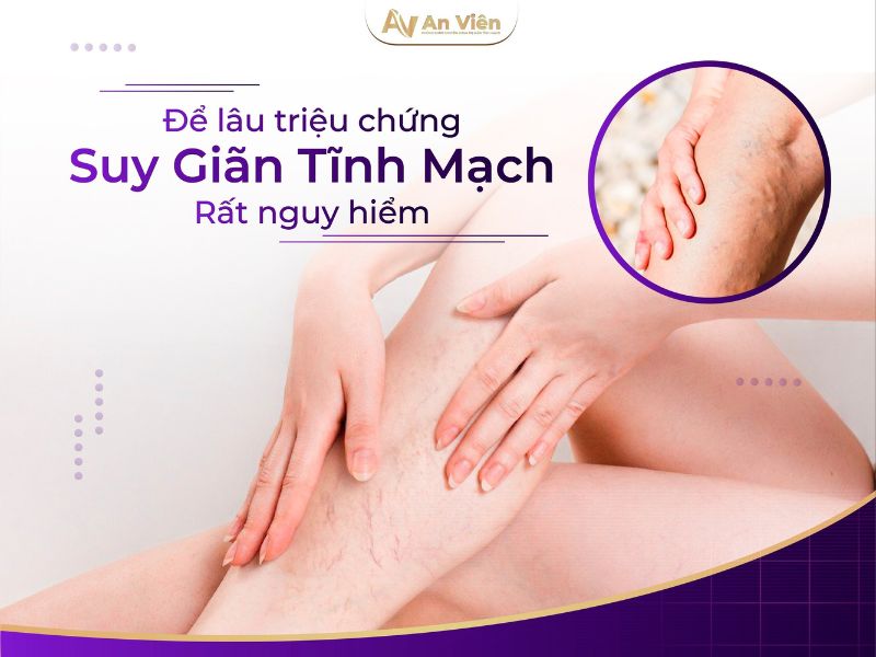 Phòng khám An Viên điều trị tĩnh mạch