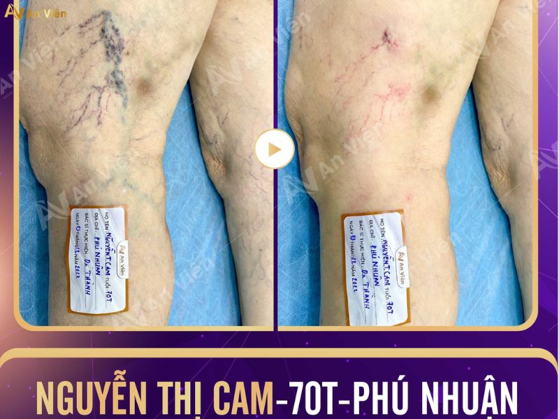 Phòng khám điều trị tĩnh mạch An Viên