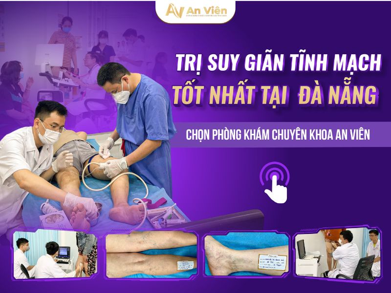 An Viên phòng khám tĩnh mạch