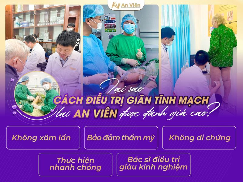 cách điều trị suy giãn tĩnh mạch An Viên