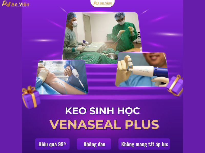 cách điều trị suy giãn tĩnh mạch An Viên
