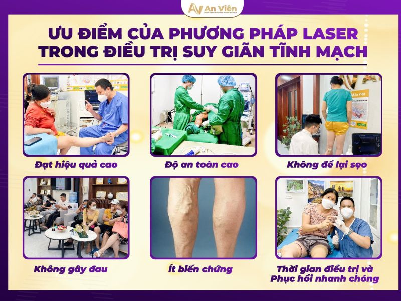 Điều trị tĩnh mạch An Viên tại Đà Nẵng