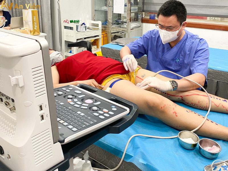 Khám bệnh giãn tĩnh mạch chân ở đâu Đà Nẵng