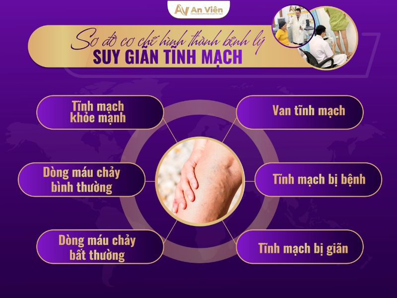 nơi khám bệnh tĩnh mạch ở TPHCM