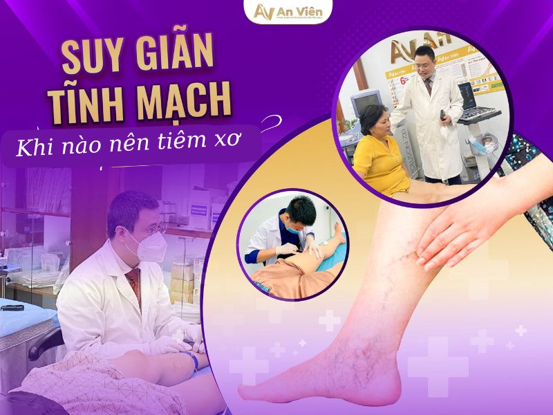 tiêm xơ tĩnh mạch An Viên