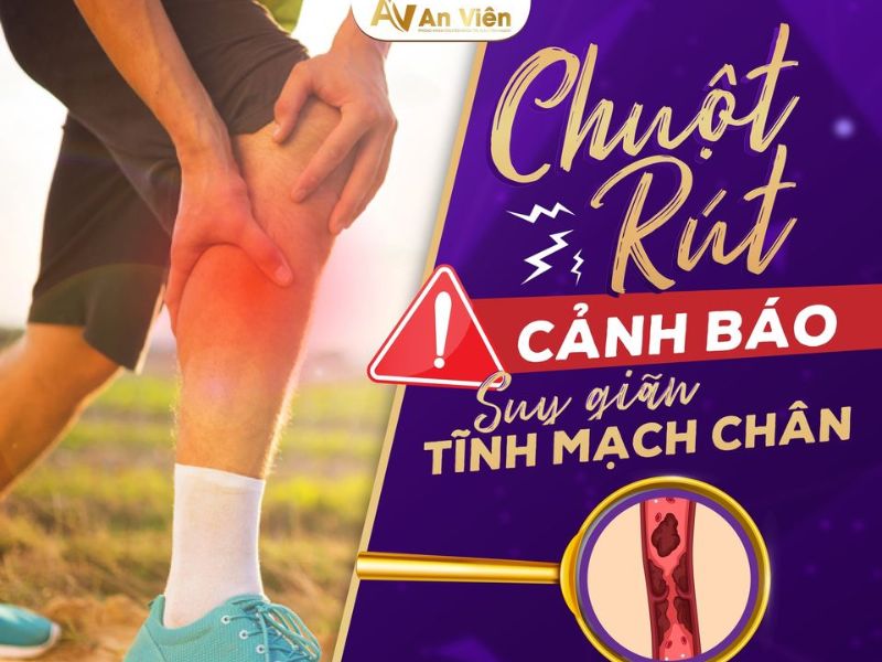 bị chuột rút khi ngủ