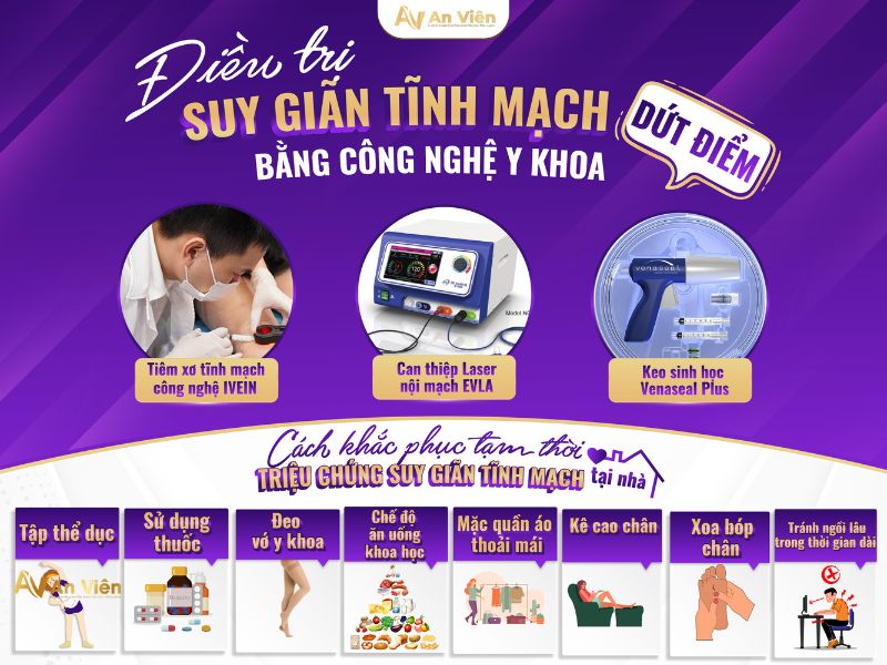 cách chữa bệnh giãn tĩnh mạch chân