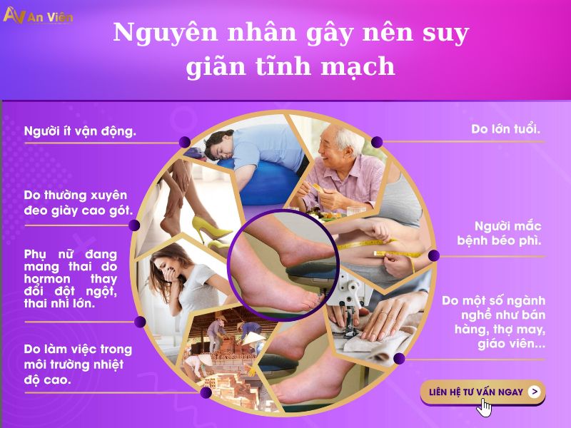 cách trị bệnh suy giãn tĩnh mạch
