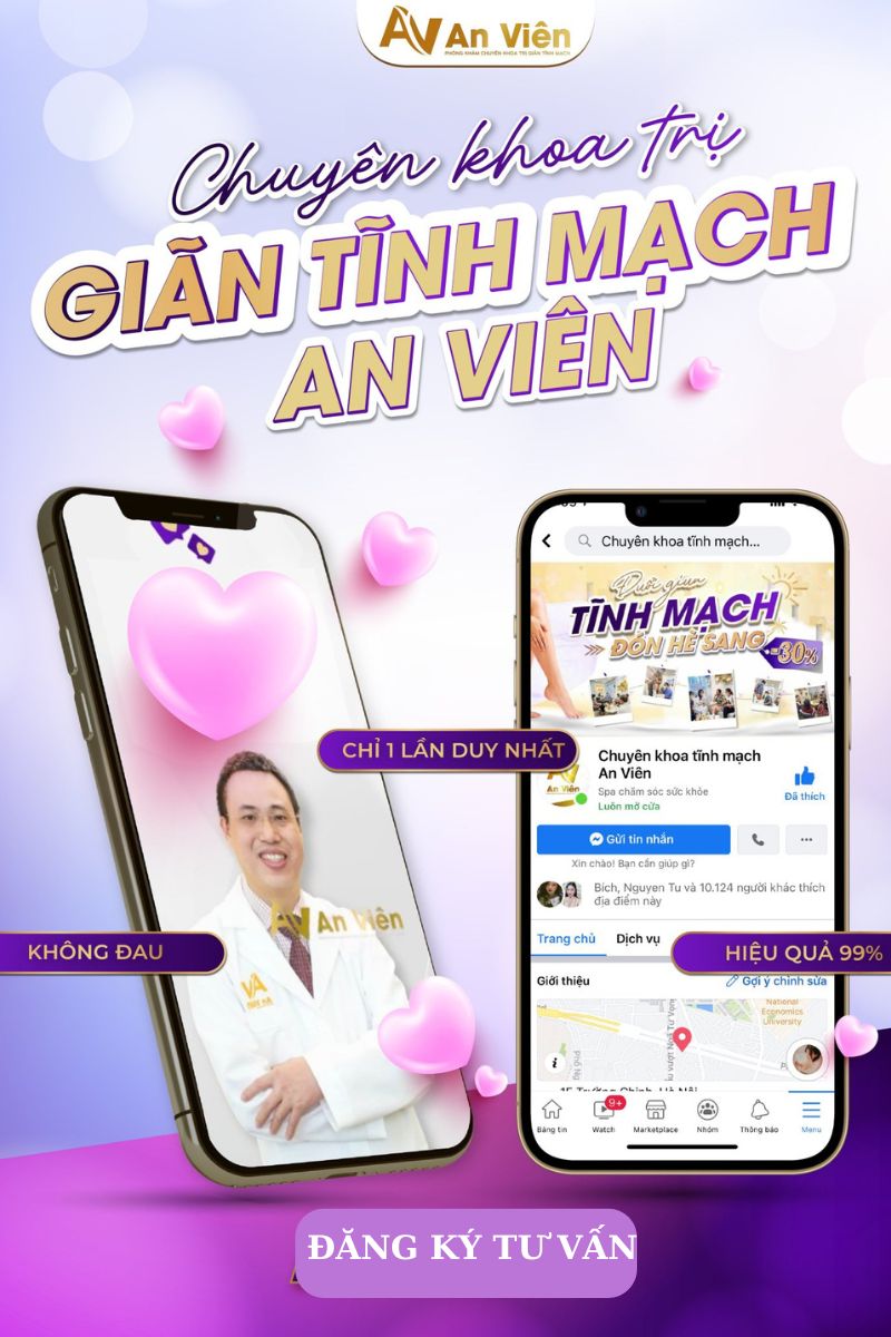 dấu hiệu của giãn tĩnh mạch
