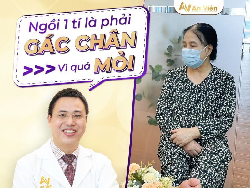 dấu hiệu của giãn tĩnh mạch