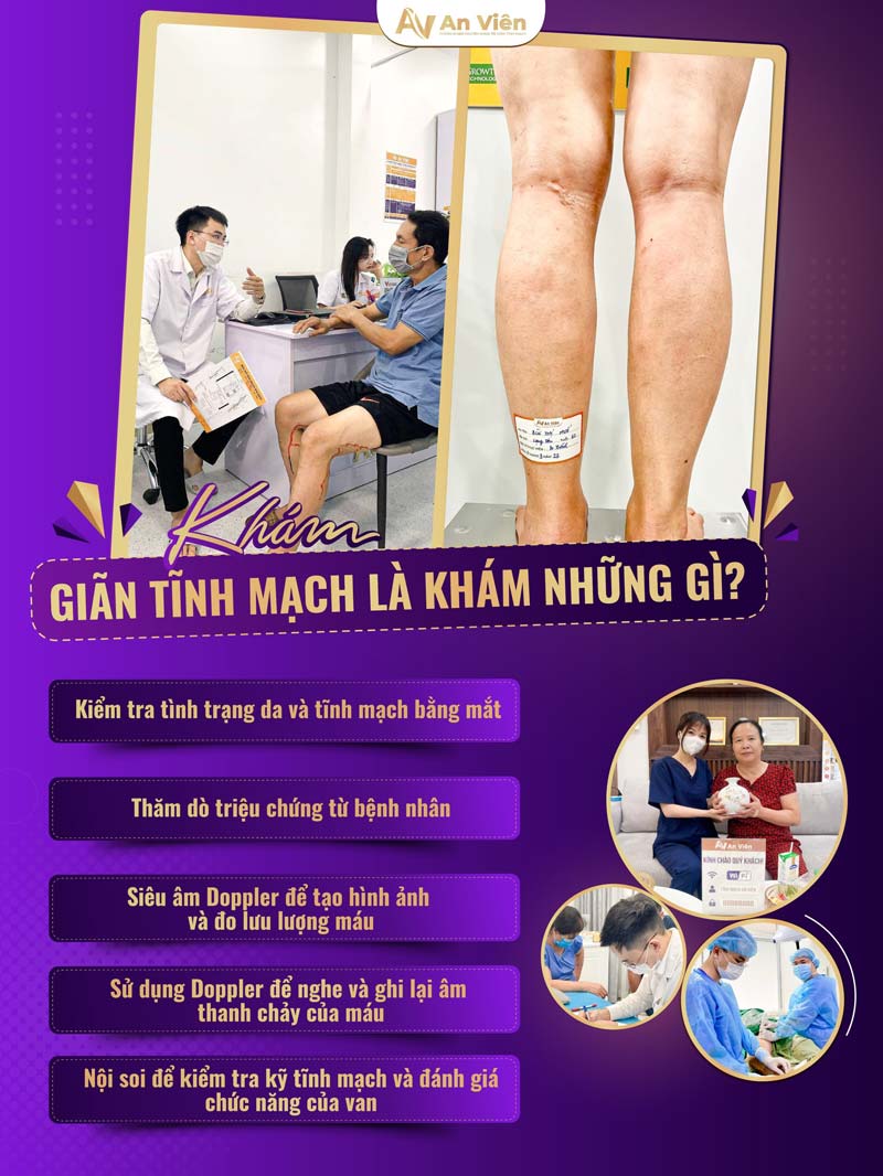 giãn tĩnh mạch khám chuyên khoa nào m