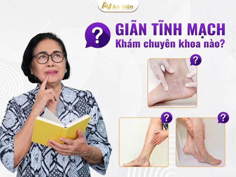 giãn tĩnh mạch khám ở khoa nào